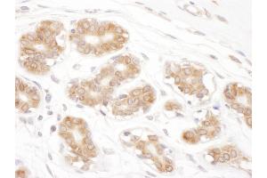 Immunohistochemistry (IHC) image for anti-Ribophorin II (RPN2) (AA 350-400) antibody (ABIN7455016)