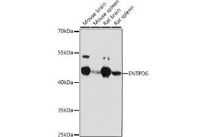 Western blot analysis of extracts of various cell lines, using ENTPD6 antibody (ABIN7266897) at 1:1000 dilution.