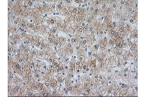 Image no. 5 for anti-Acetyl-CoA Acetyltransferase 2 (ACAT2) antibody (ABIN1496403) (ACAT2 anticorps)