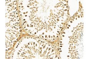 ABIN6262390 and ABIN6268885 at 1/100 staining Rat testis tissue by IHC-P. (HSPH1 anticorps  (C-Term))