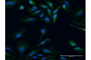 Immunofluorescence of purified MaxPab antibody to PBK on HeLa cell. (PBK anticorps  (AA 1-322))