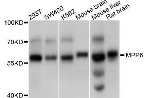 Western blot analysis of extracts of various cell lines, using MPP6 antibody (ABIN5998250) at 1/1000 dilution. (MPP6 anticorps)