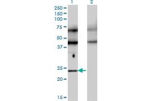 Western Blot analysis of TFEC expression in transfected 293T cell line by TFEC monoclonal antibody (M08), clone 4F11. (TFEC anticorps  (AA 1-89))