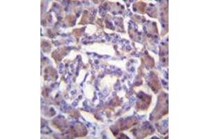 Formalin fixed and paraffin embedded human pancreas tissue reacted with RSS3 Antibody (Center) followed by peroxidase conjugation of the secondary antibody and DAB staining.