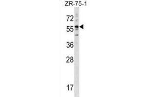 Western Blotting (WB) image for anti-Keratin 3 (KRT3) antibody (ABIN2998972)
