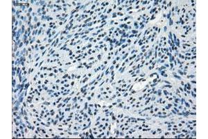 Image no. 7 for anti-Crystallin, alpha B (CRYAB) antibody (ABIN1497644) (CRYAB anticorps)