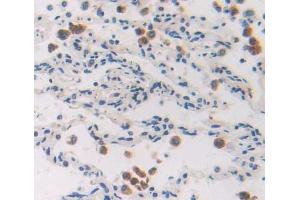 IHC-P analysis of Human Tissue, with DAB staining. (EZH1 anticorps  (AA 559-747))