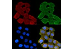 ABIN6264443 and ABIN6278623 staining Hela cells(30 min of UV treatment) by IF/ICC. (PSCA anticorps  (Internal Region))