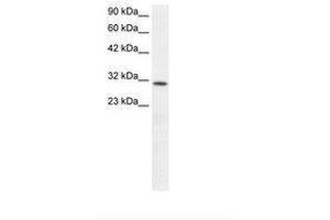 Image no. 1 for anti-Kruppel-Like Factor 8 (KLF8) (AA 89-138) antibody (ABIN6735825) (KLF8 anticorps  (AA 89-138))