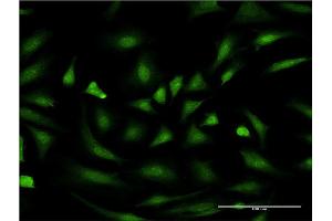 Immunofluorescence of monoclonal antibody to PIM1 on HeLa cell.