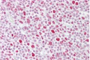 Anti-PSME3 antibody IHC staining of human tonsil.