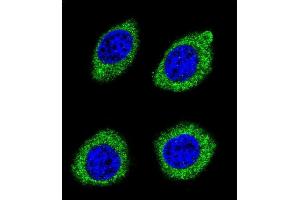 Confocal immunofluorescent analysis of HSD11B1L Antibody (C-term) (ABIN655425 and ABIN2844963) with U-251MG cell followed by Alexa Fluor 488-conjugated goat anti-rabbit lgG (green). (HSD11B1L anticorps  (C-Term))