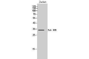 Western Blotting (WB) image for anti-RAB40B, Member RAS Oncogene Family (RAB40B) (C-Term) antibody (ABIN3186627) (RAB40B anticorps  (C-Term))