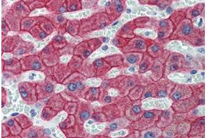 Liver, Human: Formalin-Fixed, Paraffin-Embedded (FFPE)