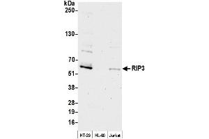 anti-Myosin Phosphatase rho Interacting Protein (MPRIP) (AA 400-450) antibody