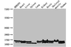 Western Blot Positive WB detected in: HEK293 whole cell lysate, Mouse heart tissue, Mouse liver tissue, Mouse spleen tissue, Mouse lung tissue, Mouse kidney tissue, Mouse brain tissue, Mouse skeletal muscle tissue, Mouse thymus tissue All lanes: NDUFB6 antibody at 3 μg/mL Secondary Goat polyclonal to rabbit IgG at 1/50000 dilution Predicted band size: 16, 14 kDa Observed band size: 16, 14 kDa