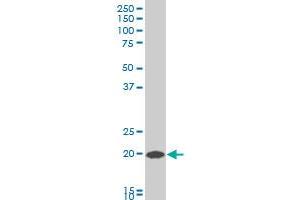 COMMD1 polyclonal antibody (A01), Lot # 060802QCS1 Western Blot analysis of COMMD1 expression in HepG2 .