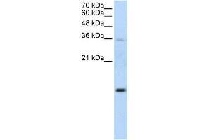 WB Suggested Anti-UBE2D2 Antibody Titration:  1. (UBE2D2 anticorps  (Middle Region))