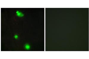 Immunofluorescence analysis of MCF-7 cells, using SFRS3 antibody.