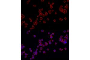 Immunofluorescence analysis of THP-1 cells using TLR4 Rabbit pAb (ABIN6134489, ABIN6149223, ABIN6149226 and ABIN6220893) at dilution of 1:100 (40x lens).