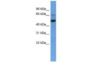 WB Suggested Anti-IQCB1 Antibody Titration: 0. (IQCB1 anticorps  (C-Term))