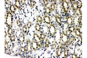 Anti- TCPTP Picoband antibody,IHC(P) IHC(P): Rat Kidney Tissue