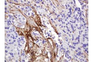 Image no. 1 for anti-GTPase NRas (NRAS) antibody (ABIN1499821)