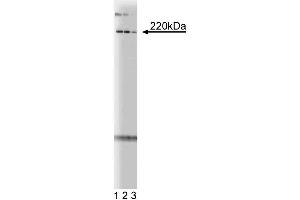 Western blot analysis of pericentrin on mouse neonate lysate. (PCNT anticorps  (AA 1692-1814))