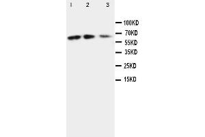 Anti-CX3CL1 antibody, Western blotting Lane 1: Recombinant Mouse Fractalkin Protein 10ng Lane 2: Recombinant Mouse Fractalkin Protein 5ng Lane 3: Recombinant Mouse Fractalkin Protein 2. (CX3CL1 anticorps  (N-Term))