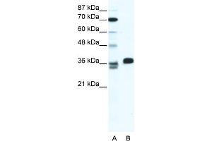 WB Suggested Anti-ESX1 Antibody Titration:  1.