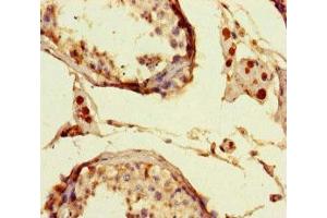 Immunohistochemistry of paraffin-embedded human testis tissue using ABIN7150193 at dilution of 1:100 (LIG3 anticorps  (AA 809-928))