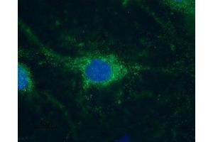 Expression of HCN1 in rat DRG primary culture - Immunocytochemical staining of paraformaldehyde-fixed and permeabilized rat DRG primary culture.