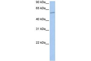 Western Blotting (WB) image for anti-Membrane Bound O-Acyltransferase Domain Containing 1 (MBOAT1) antibody (ABIN2459208)