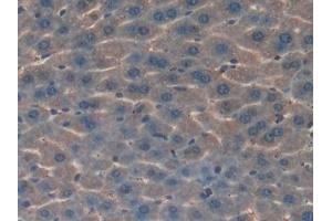 Detection of HGD in Mouse Liver Tissue using Polyclonal Antibody to Homogentisate-1,2-Dioxygenase (HGD)