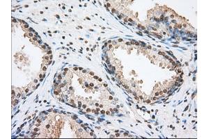 Image no. 11 for anti-Transforming, Acidic Coiled-Coil Containing Protein 3 (TACC3) antibody (ABIN1498099) (TACC3 anticorps)