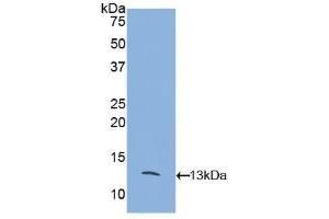 Detection of Recombinant MCP2, Mouse using Polyclonal Antibody to Monocyte Chemotactic Protein 2 (MCP2) (CCL8 anticorps  (AA 20-94))