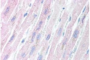 Human Heart (formalin-fixed, paraffin-embedded) stained with AES antibody ABIN213897 at 5 ug/ml followed by biotinylated goat anti-rabbit IgG secondary antibody ABIN481713, alkaline phosphatase-streptavidin and chromogen. (AES anticorps  (N-Term))