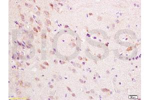 Formalin-fixed and paraffin embedded rat brain tissue labeled with Anti-ChRM1/Acetylcholine receptor(M1) Polyclonal Antibody, Unconjugated (ABIN738396) at 1:200 followed by conjugation to the secondary antibody, (SP-0023), and DAB staining (CHRM1 anticorps  (AA 321-420))