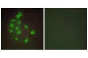Immunofluorescence analysis of A549 cells, using HAND1 antibody. (HAND1 anticorps)