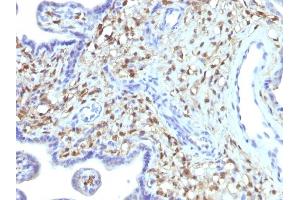 Formalin-fixed, paraffin-embedded human Placenta stained with S100A4 Mouse Monoclonal Antibody (S100A4/1481). (s100a4 anticorps  (AA 1-200))