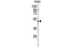 Western Blotting (WB) image for anti-Aldehyde Dehydrogenase 5 Family, Member A1 (ALDH5A1) antibody (ABIN2998190) (ALDH5A1 anticorps)