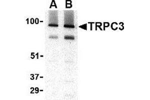 Western Blotting (WB) image for anti-Transient Receptor Potential Cation Channel, Subfamily C, Member 3 (TRPC3) (C-Term) antibody (ABIN1030778) (TRPC3 anticorps  (C-Term))