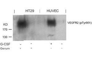 Image no. 2 for anti-VEGF Receptor 2 (VEGFR2) (pTyr951) antibody (ABIN196770) (VEGFR2/CD309 anticorps  (pTyr951))