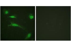 Immunofluorescence analysis of HeLa cells, using p53 (Ab-20) Antibody. (p53 anticorps  (AA 10-59))