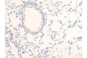 ABIN6267269 at 1/100 staining rat lung tissue sections by IHC-P. (EGFR anticorps  (pSer1071))