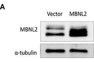 Overexpression of MBNL2 suppressed proliferation and invasion in Hep-J5 HCC cell lineA. (TUBA1B anticorps)