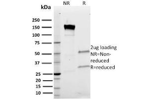SDS-PAGE Analysis Purified Band III Mouse Monoclonal Antibody (Q1/156). (Band 3/AE1 anticorps)