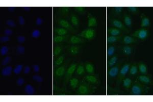 Detection of MyD88 in Human HepG2 cell using Polyclonal Antibody to Myeloid Differentiation Factor 88 (MyD88)
