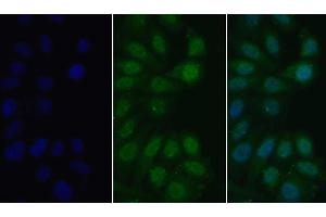 Detection of MyD88 in Human HepG2 cell using Polyclonal Antibody to Myeloid Differentiation Factor 88 (MyD88) (MYD88 anticorps  (AA 32-265))