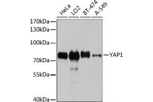 Western blot analysis of extracts of various cell lines using YAP1 Polyclonal Antibody at dilution of 1:1000. (YAP1 anticorps)